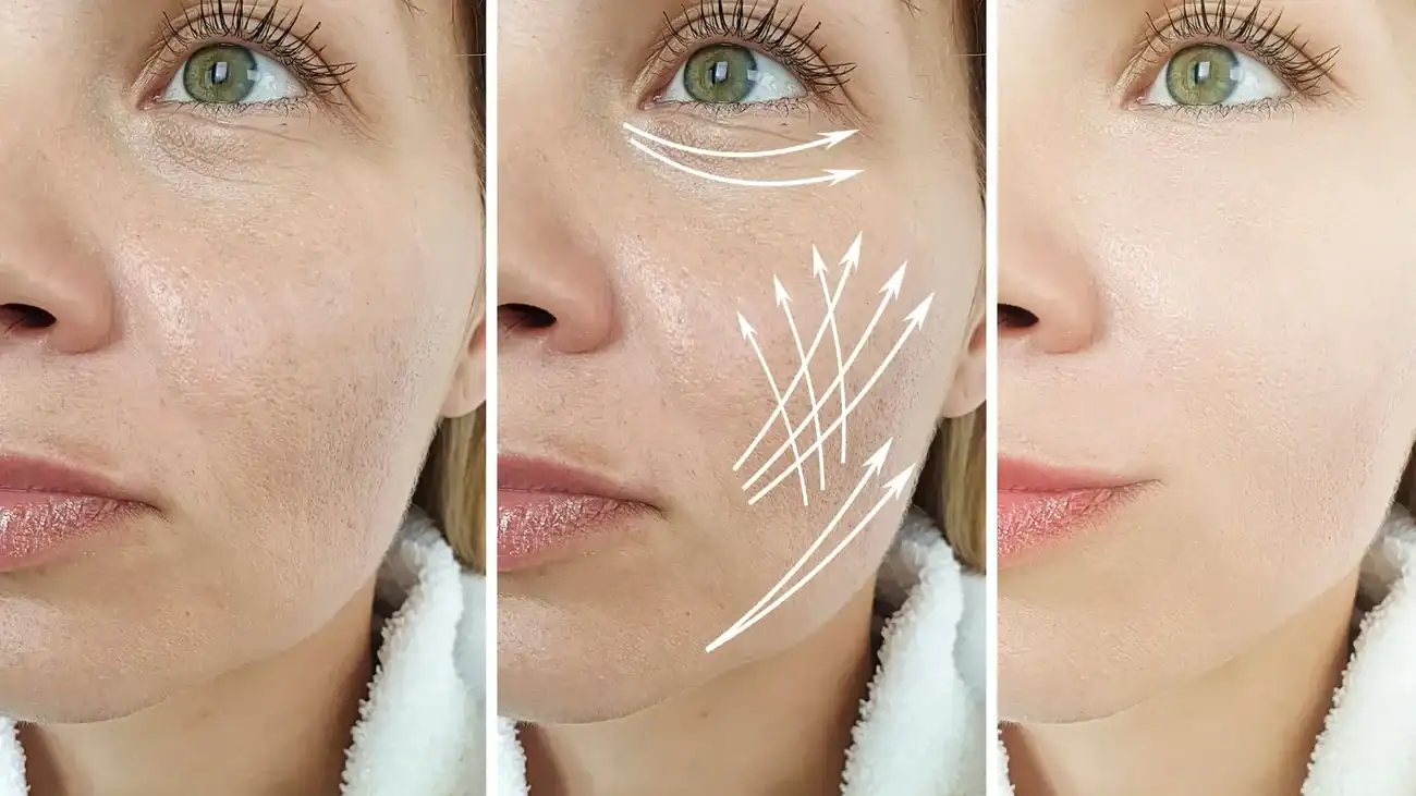 Can One Treatment Really Tackle More Than One Skin Concern Hadleigh?