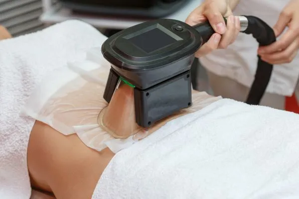 Image of person having fat freezing treatment to help weight gain Hadleigh