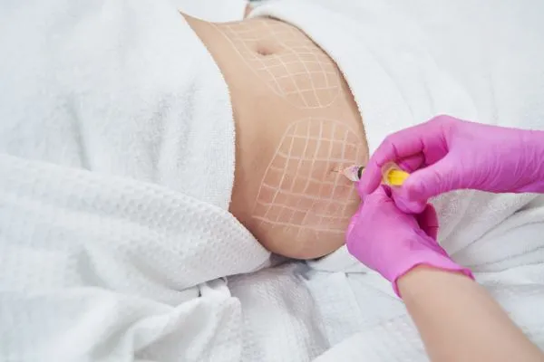 image of fat dissolving injections on love handles to help combat weight gain Hadleigh