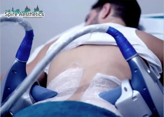 Man having fat freezing treatment done on love handles before a competitions Hadleigh to create a sculpted look.