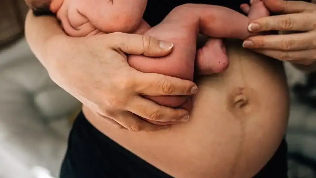 Why Is My Stomach Still Big After Pregnancy Hadleigh?
